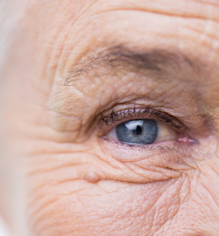 cataract procedure close-up of eye