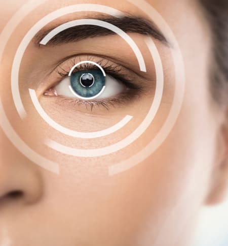 lasik procedure