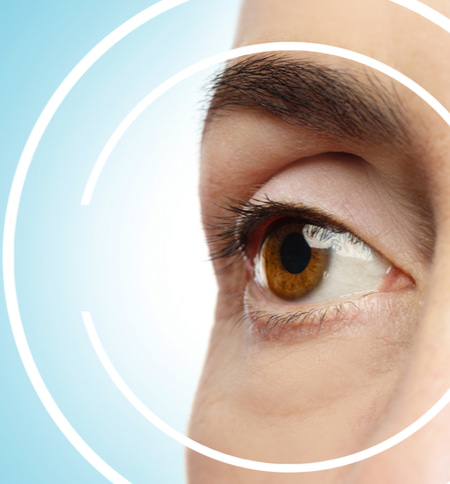 laser eye treatment