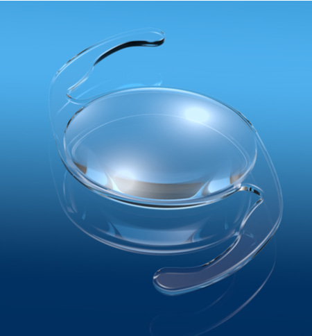 single focus iol lens