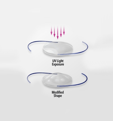 Light Adjustable Lens graphic